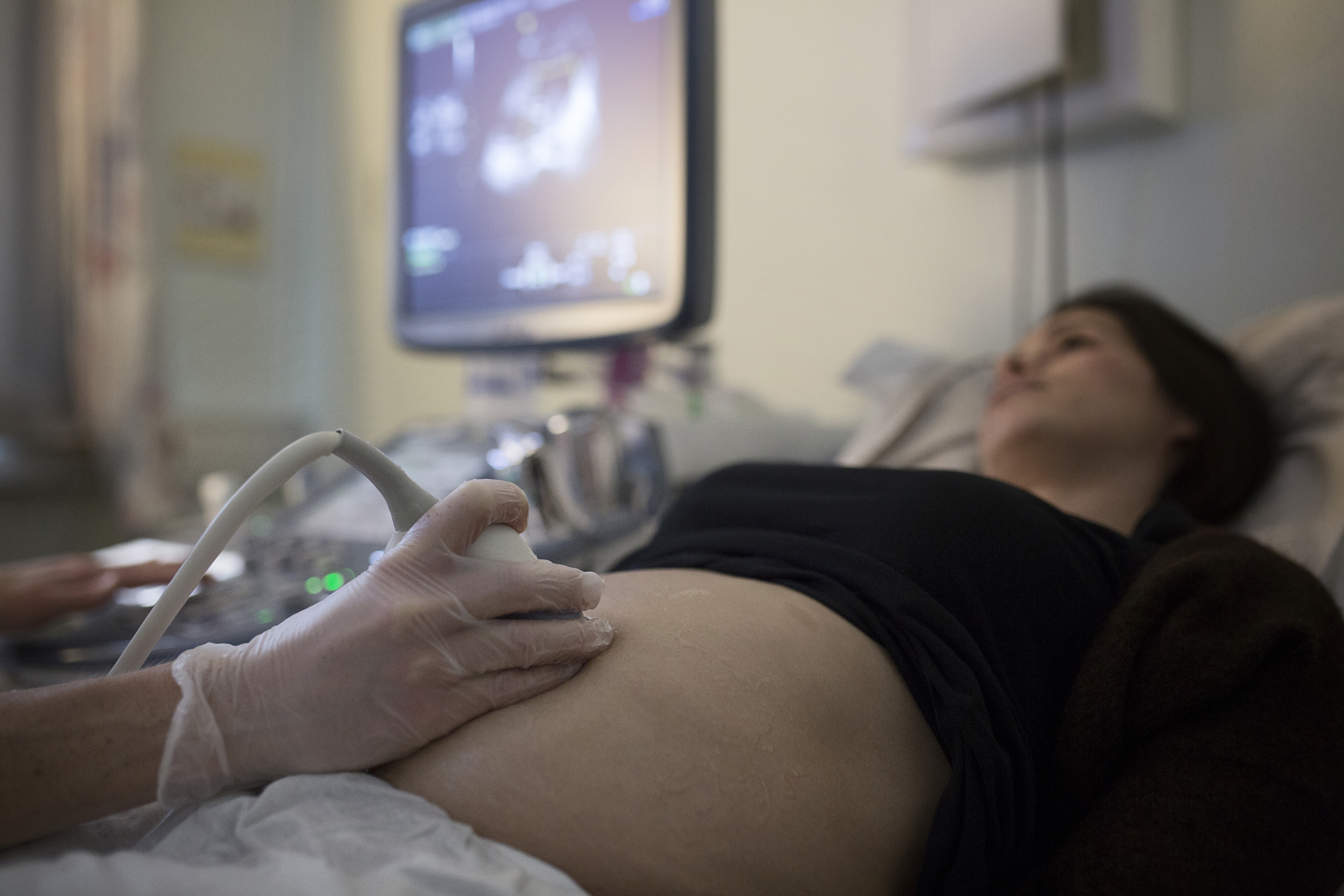 ultralyd av gravid kvinne