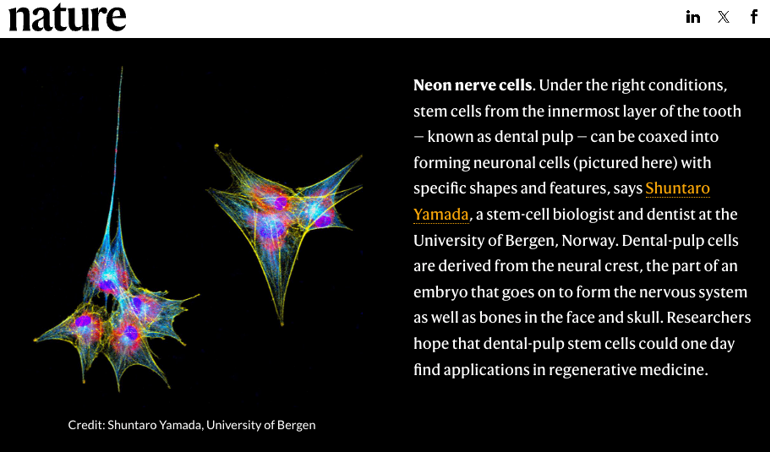 Screenshot of Dr. Yamada's mage publised in Nature