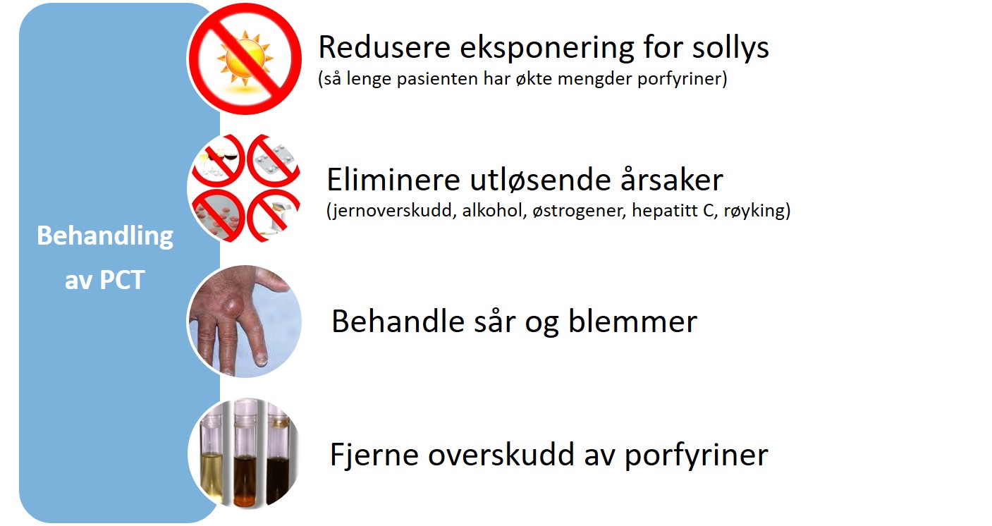 Modell: De fire behandlingskomponentene - redusere eksponering for sollys, eliminere utløsende årsaker, behandle sår og blemmer, fjerne overskudd av porfyriner