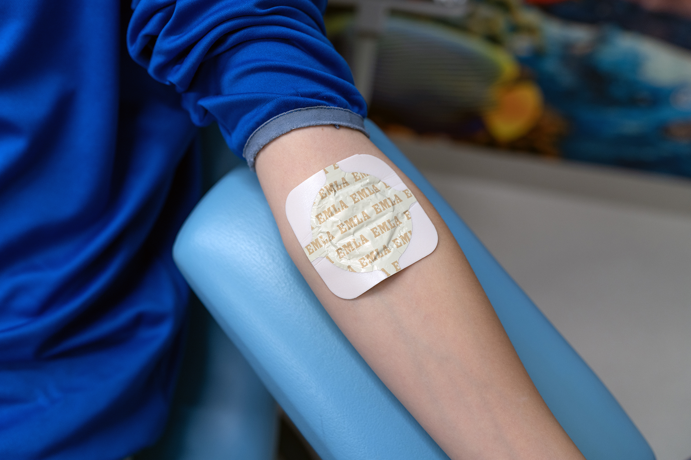 Emlaplaster i albogen