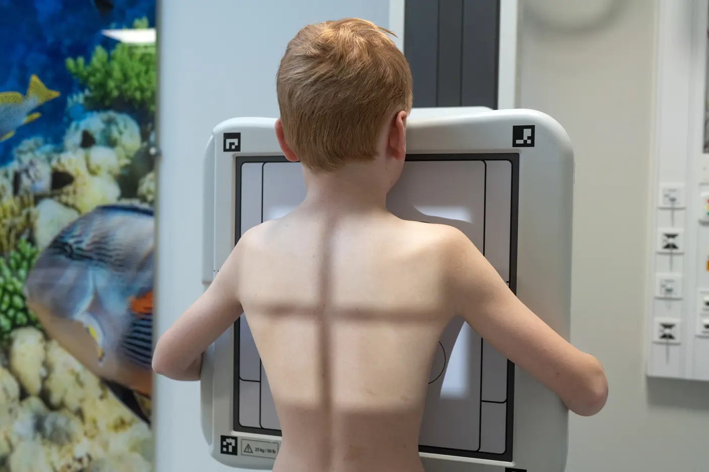 En gutt står inntil et røntgenapparat