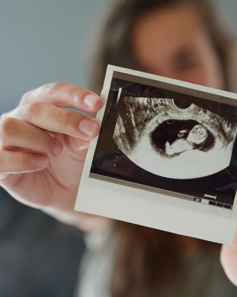 En gravid kvinne holder frem et ultralydbilde av fosteret