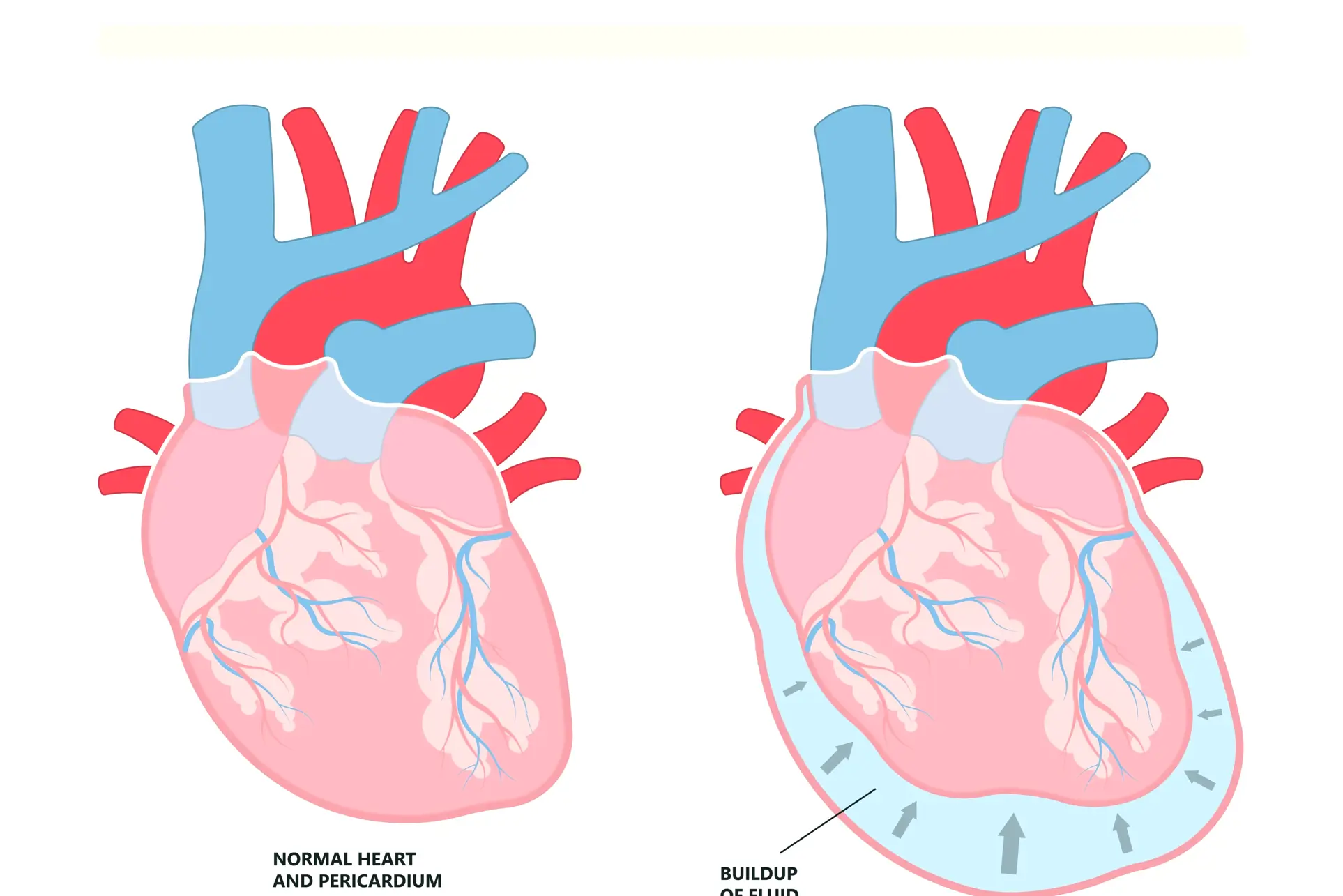 Diagram av hjerteposen