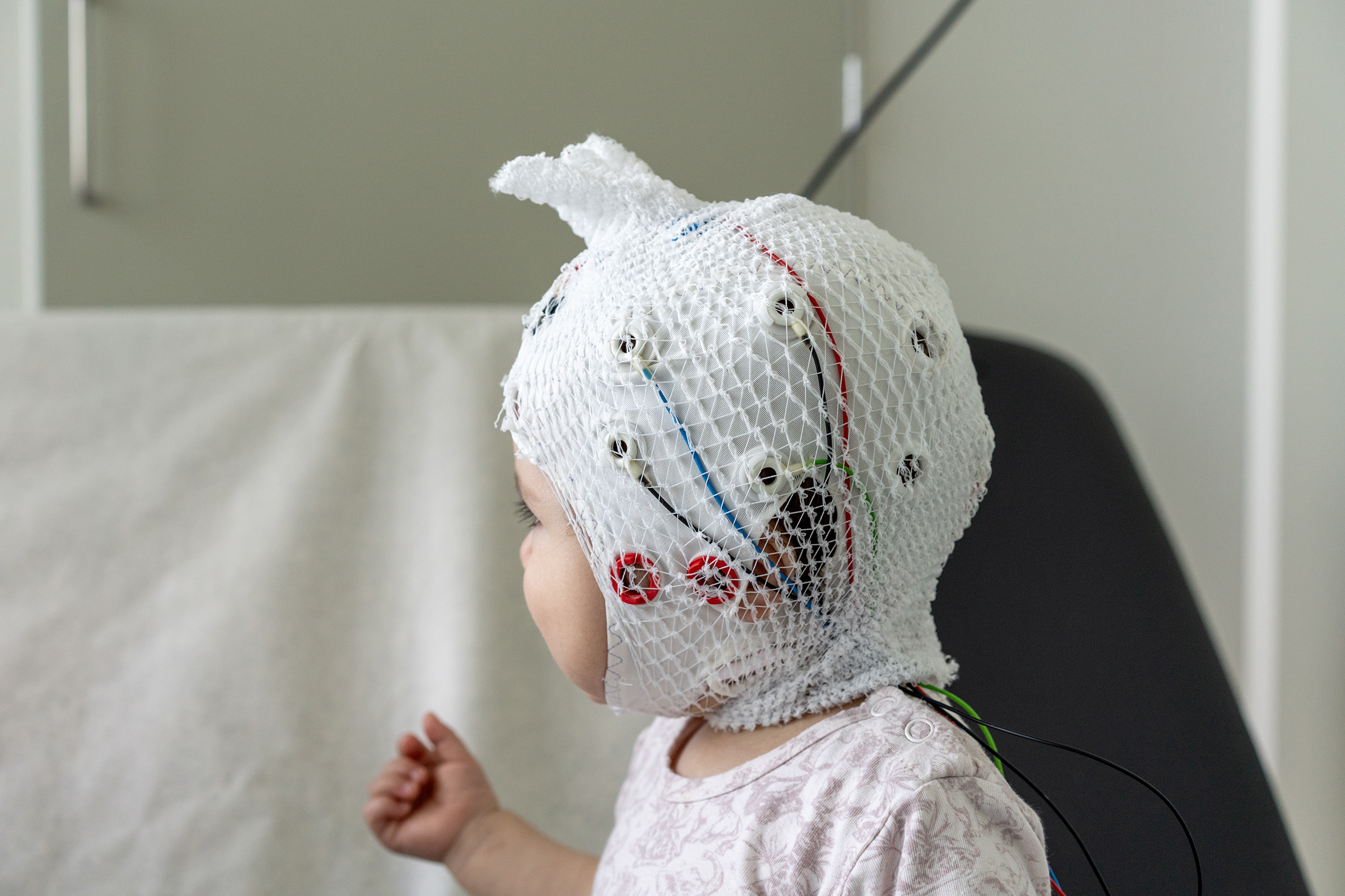 Et barn med EKG-hette og netting utenpå