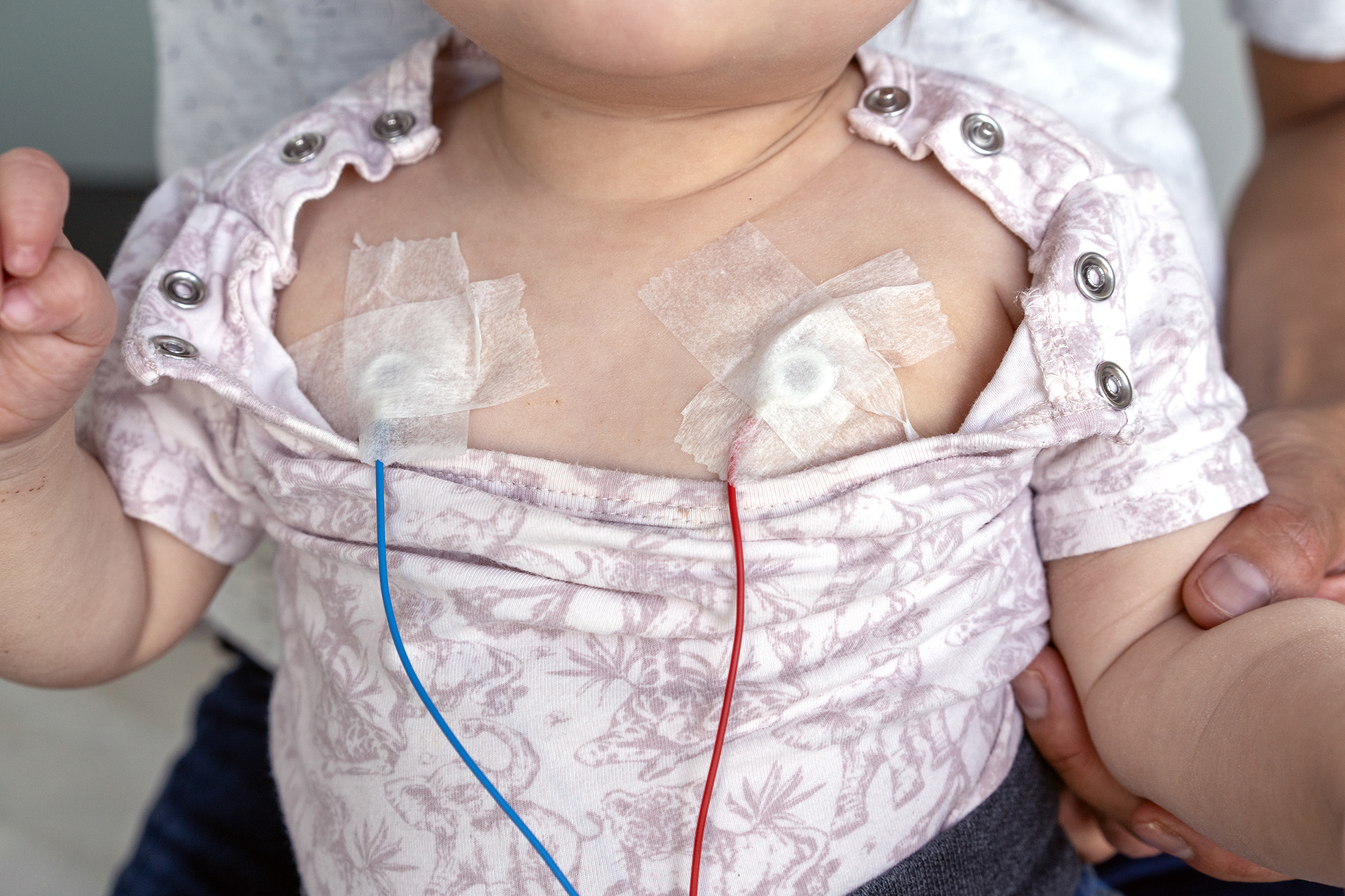 Et barn med plasterlapper på brystet