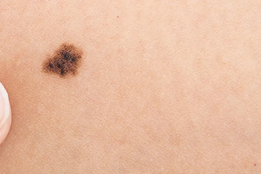 En liten svart edderkopp på en persons finger