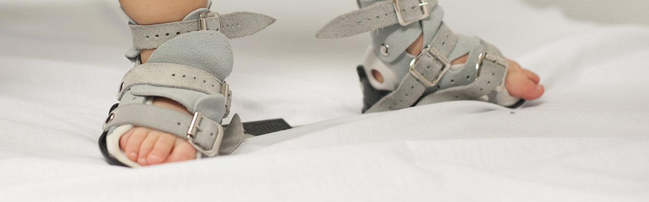 Barneføtter med skinner. Foto