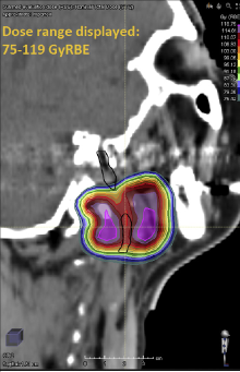 Et skjermbilde av et videospill