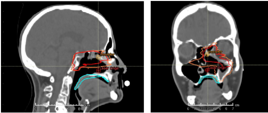 Et par hodetelefoner