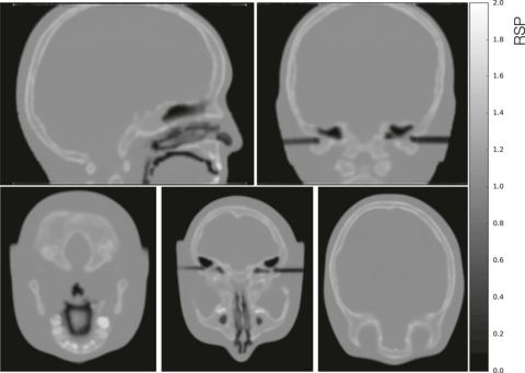 En collage av innsiden av en menneskeskalle
