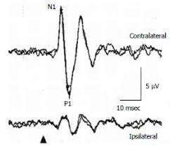 Grafisk fremstilling. Resultat fra måling med Videohodeimpulstest. 