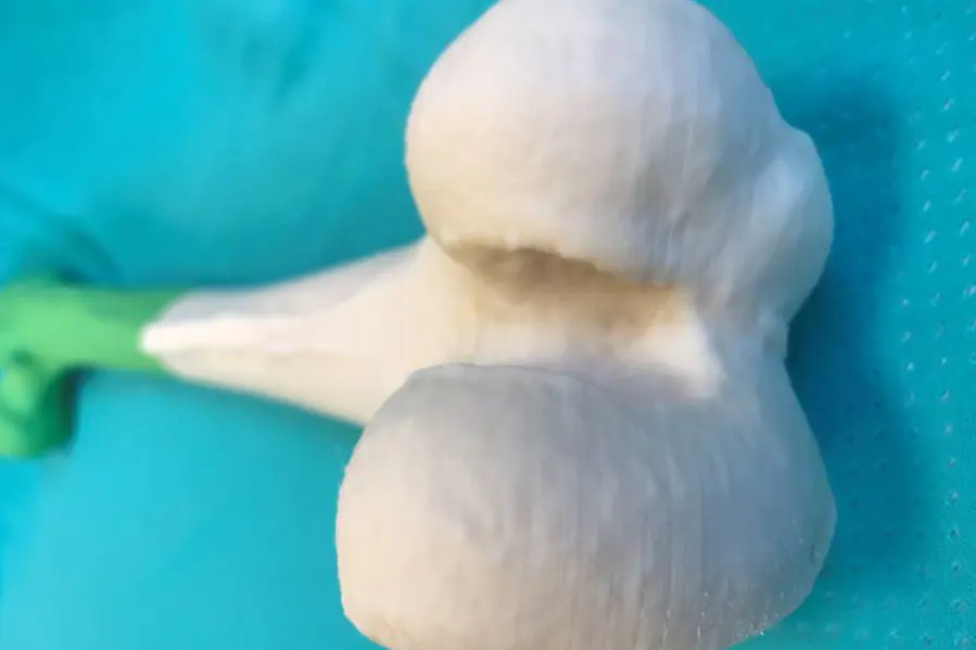 3D modell av knokkel. Foto