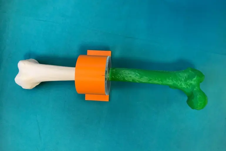 3D modell lårbein. Foto