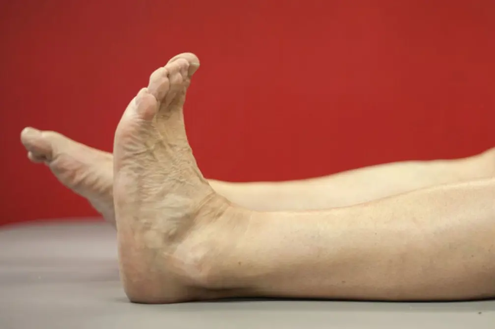 Ankelledd bøyd oppover. Foto