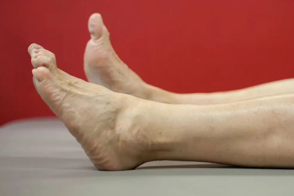 Føtter, ankelledd avslappet. Foto