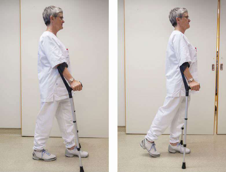 Montasje - to bilder; krykker plasseres fremover, operert fot plasseres mellom krykker. foto