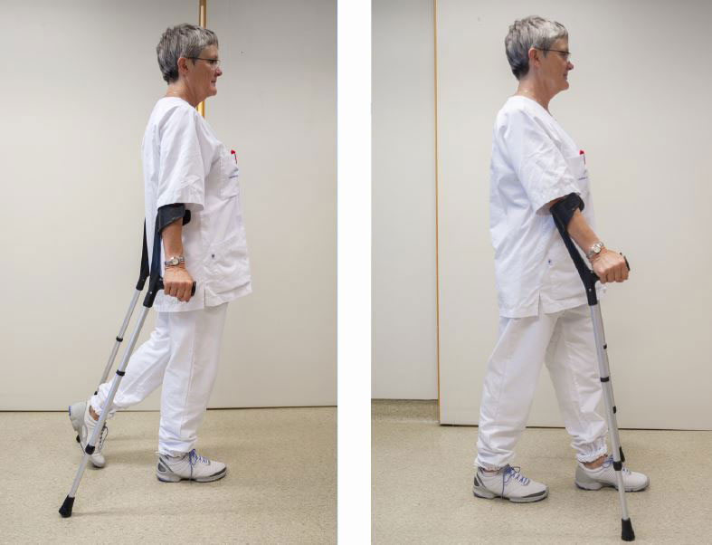 Montasje - to bilder; uoperert fot frem med tyngde på, krykker fremover på nytt. Foto