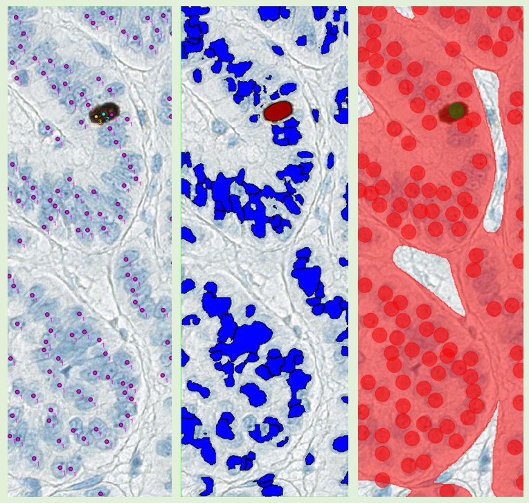 Image analysis Ki-67