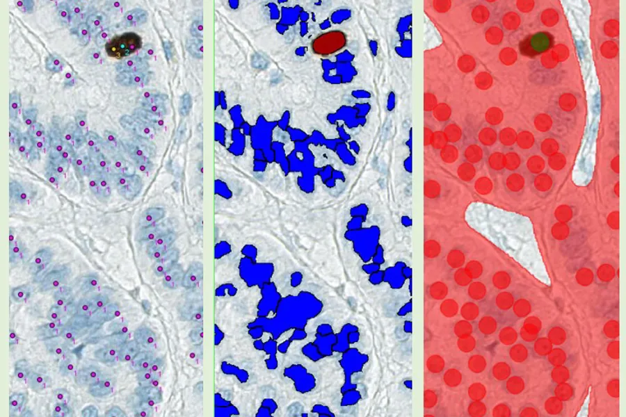 Image analysis Ki-67