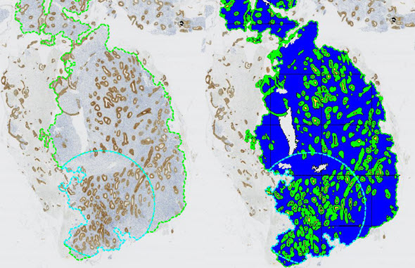 Quantitative analysis of EIN