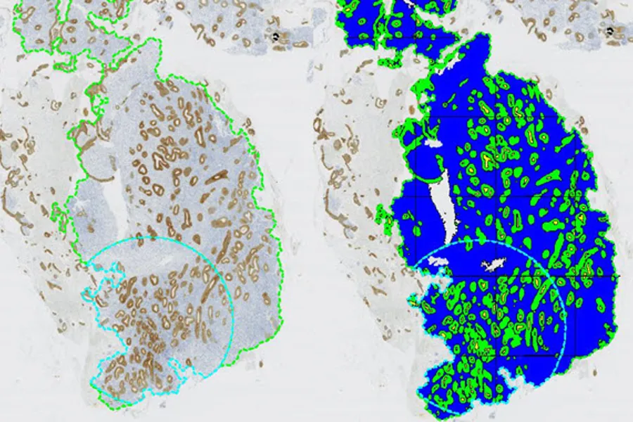 Quantitative analysis of EIN