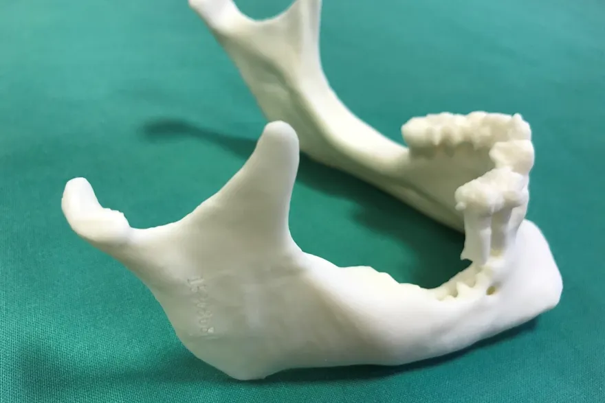 3D-modell av underkjeve. Foto