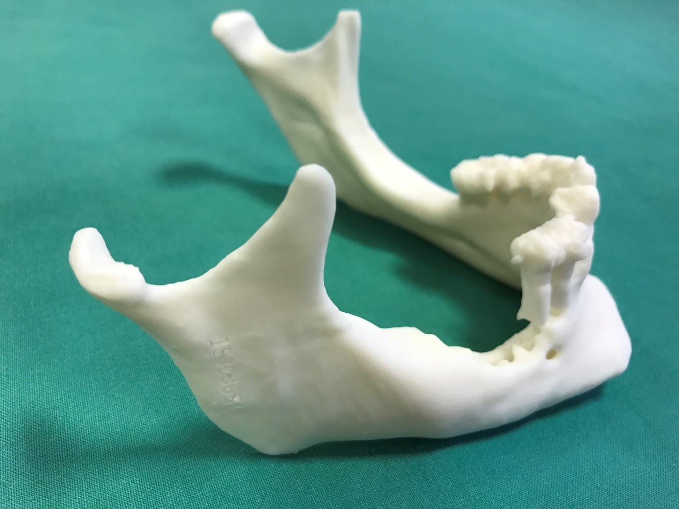 3D-modell av underkjeve. Foto