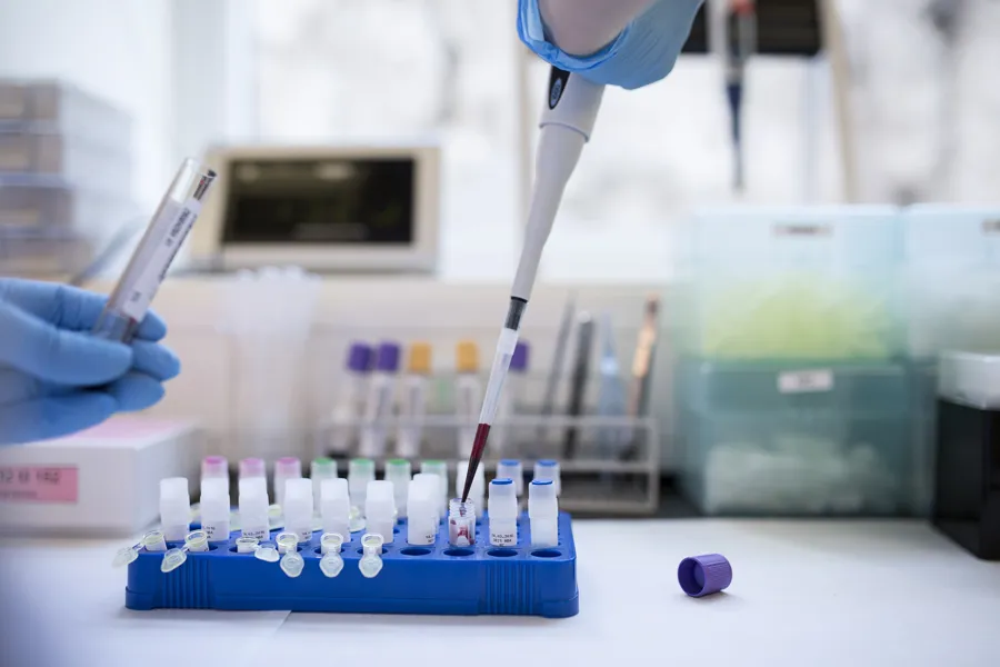 Prøveglass på laboratorium. Foto