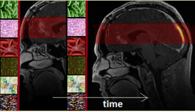 A black and red helmet