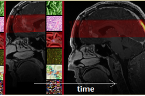 A black and red helmet