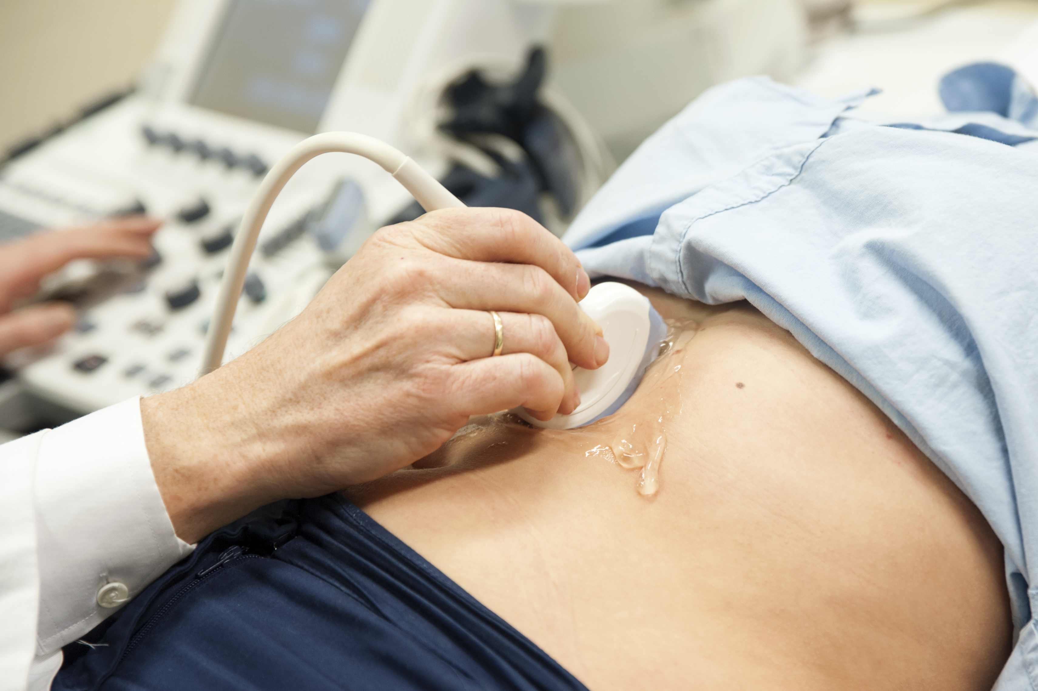 Kvinne ligger på undersøkelsesbenk og blir undersøkt med ultralyd. Foto