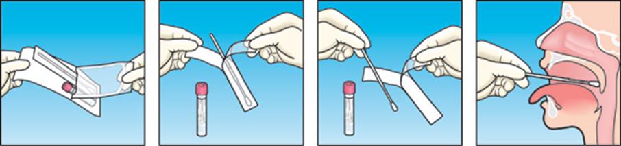 Bruksanvisning prøvetaking nummererte bilder 1-4. Illustrasjon. 