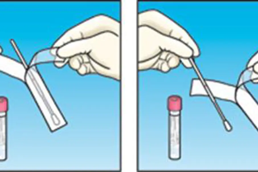 Bruksanvisning prøvetaking nummererte bilder 1-4. Illustrasjon.