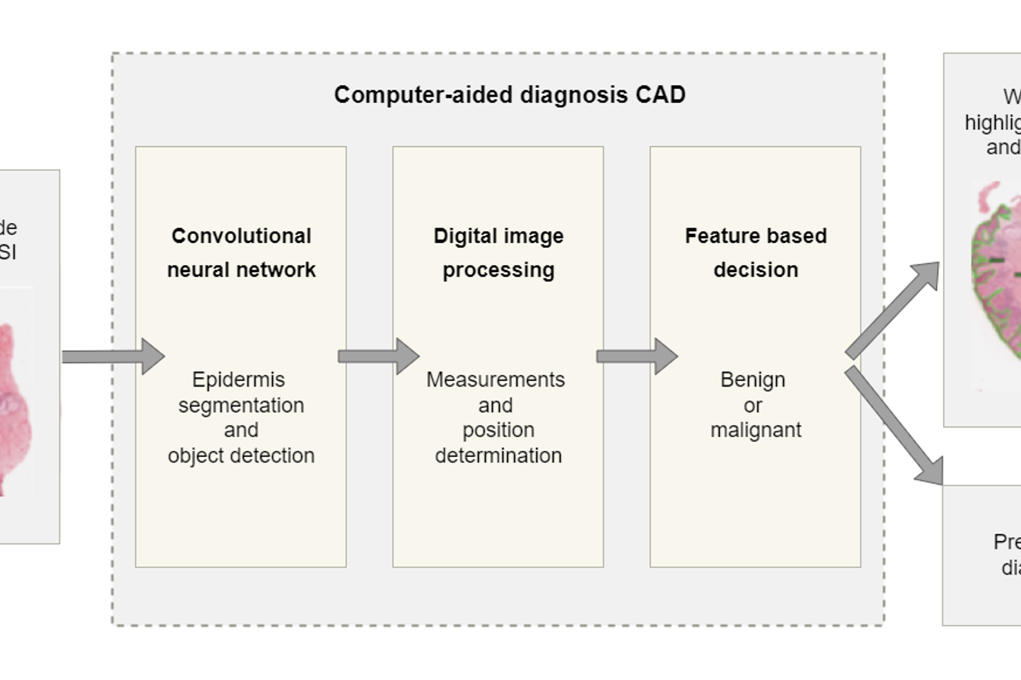 Image - Computer-aided Diagnostic (CAD) process. Illustration