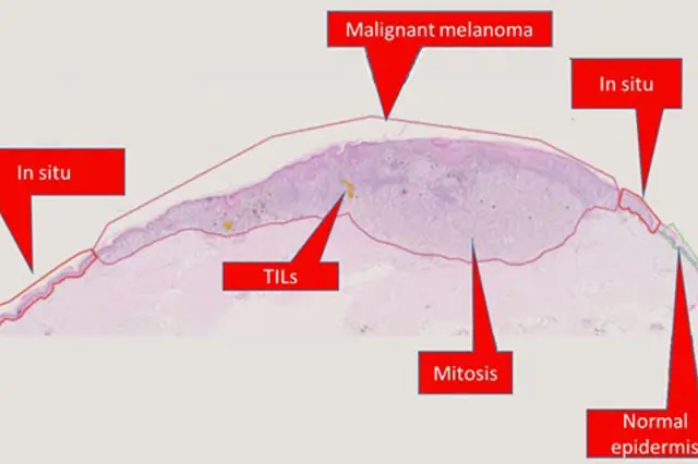 Annotations slide image