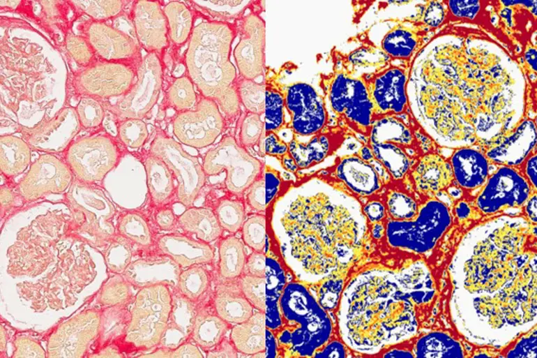 image analysis