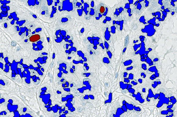 conventional image analysis