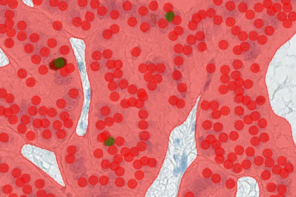 machine learning system