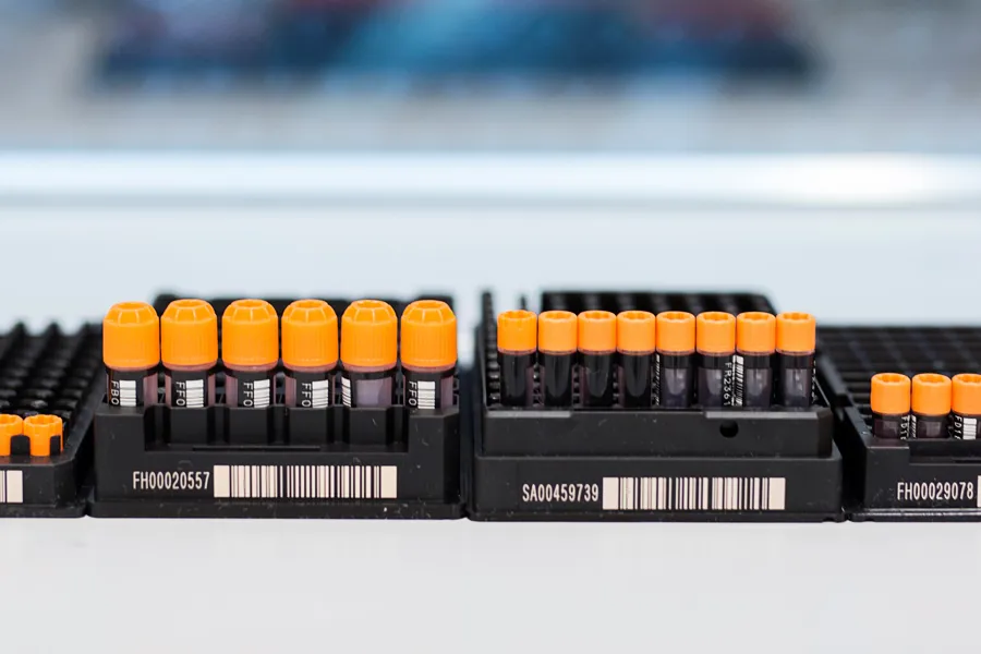 Prøveglass/røyr i fire ulike storleikar med gul kork står stilt opp ved sida av kvarandre. Foto