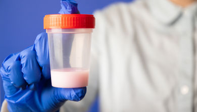 Health personell holding cup with Semen sample. Photo