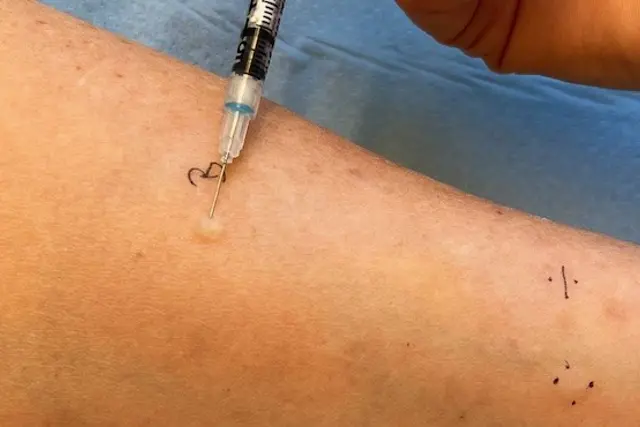 Et nærbilde av en nål på en persons arm