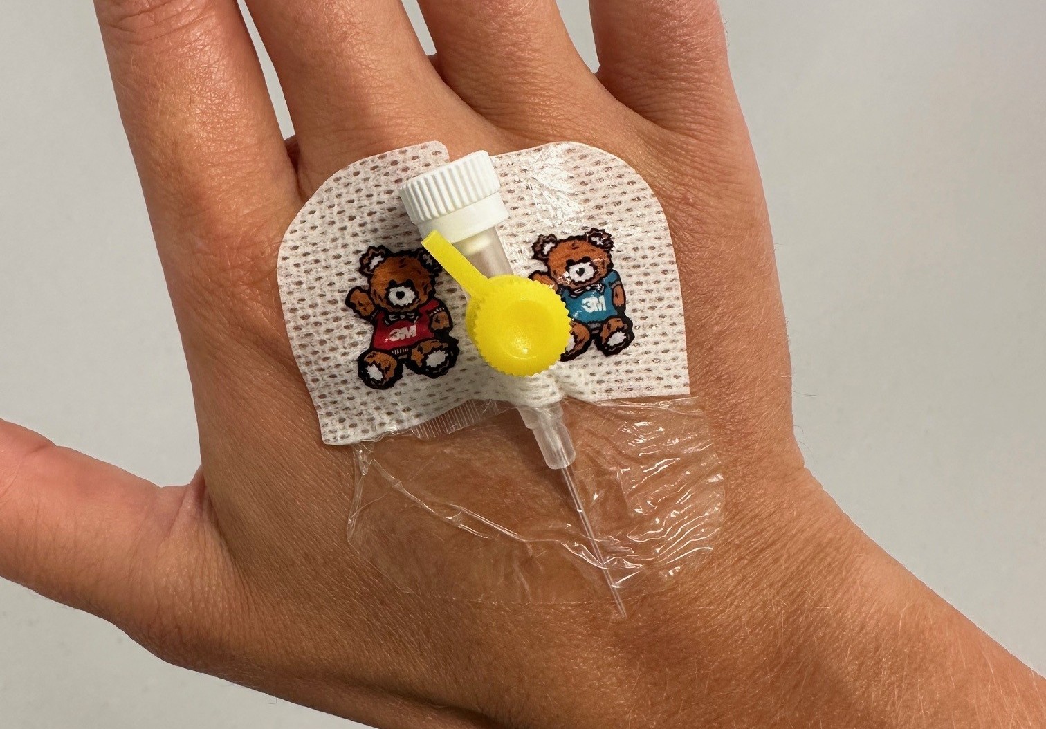 En hånd som har en veneflon med et plaster på