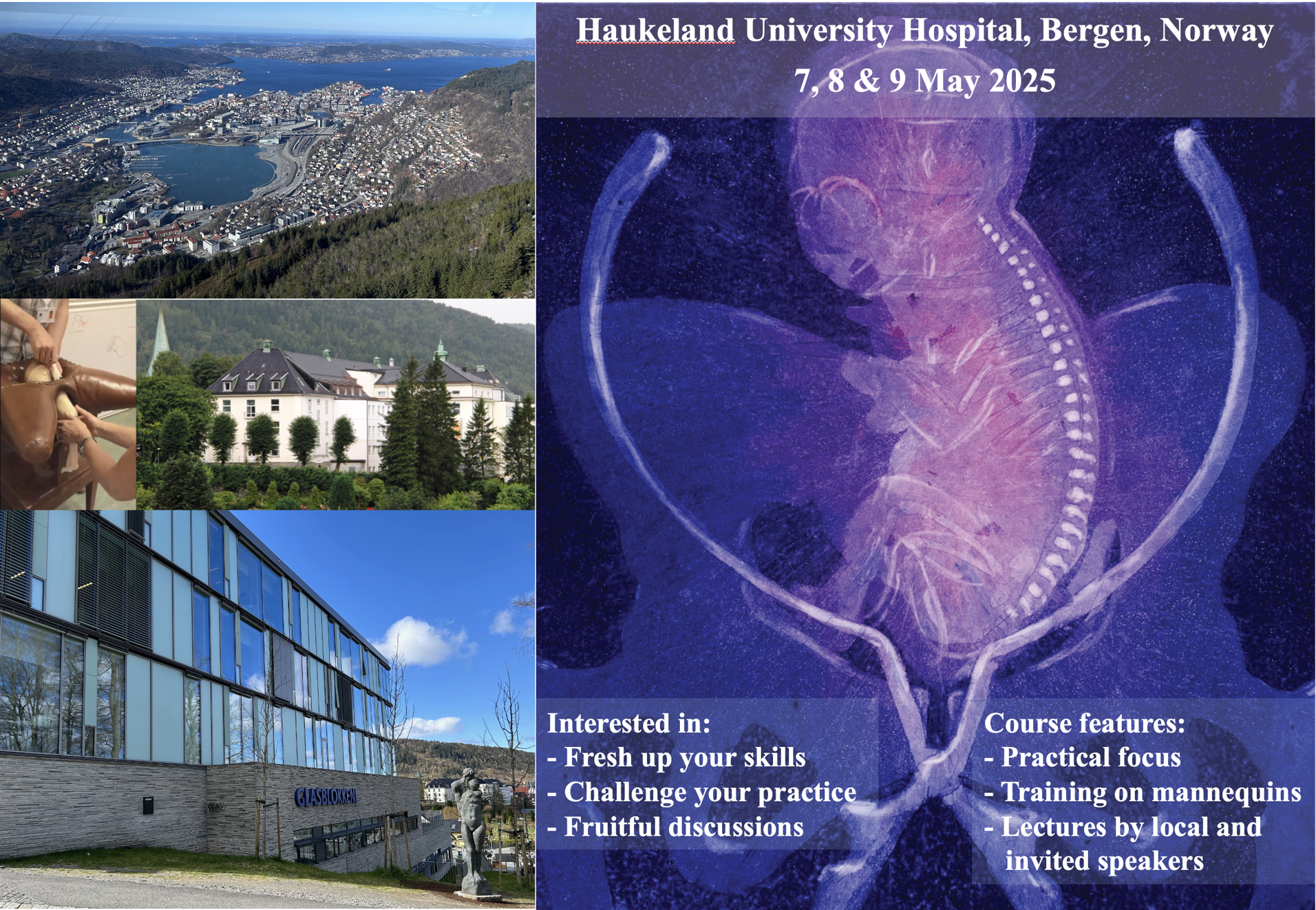 Bilde som visar eit foster i seteleie, samt to bilde av Bergen by