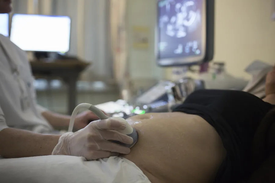 gravid kvinne på ultralydundersøkelse